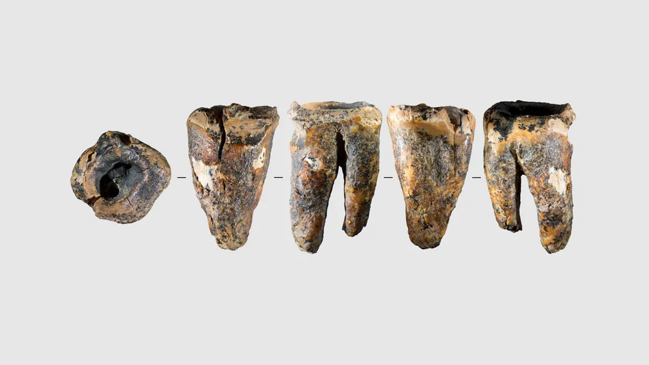 59 bin yıllık azı dişi, tıp dünyasını şaşırttı